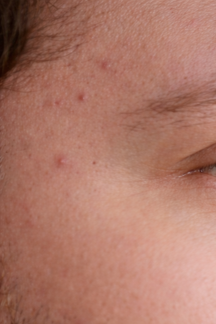 FEWER BREAKOUTS - After