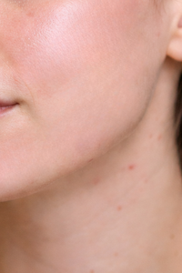 Fewer breakouts.